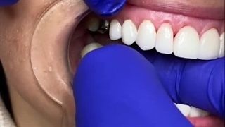 دکتر محمدرضا چالاک پروتز دندان